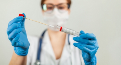 Covid-19 : ne reculons pas le moment d'appliquer les propositions de la profession pour améliorer la stratégie "Tester - Tracer - Isoler" !