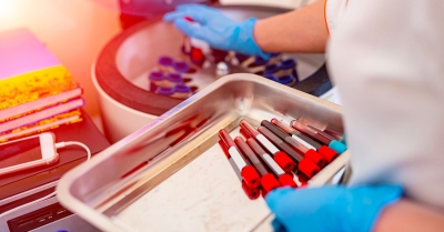 Risque de rupture : Questionnaire de la DGS sur l'impact du nouveau règlement européen  sur la fourniture des DMDIV aux laboratoires